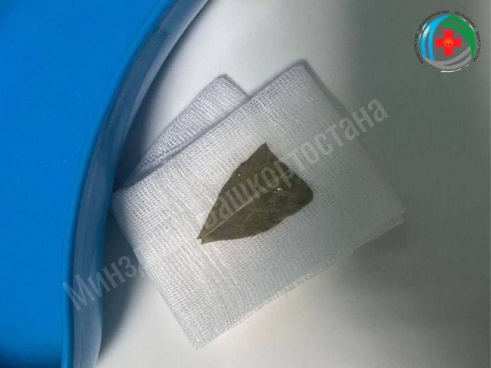 Жительница Башкирии едва не задохнулась из-за лаврового листа